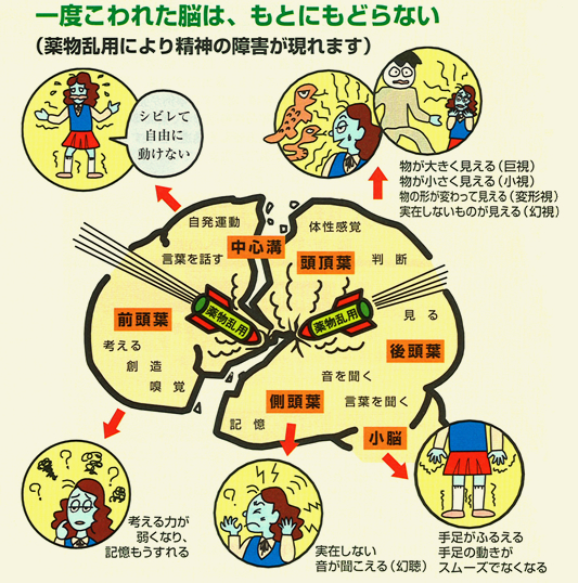 一度こわれた脳は、もとにもどらない
